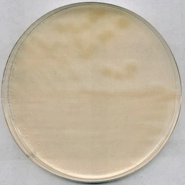 Imagem de referência de AGAR R2A P/ MICROBIOLOGIA 100416 – 500G